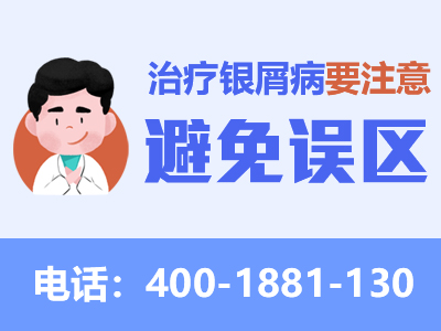成都治疗牛皮癣专科医院